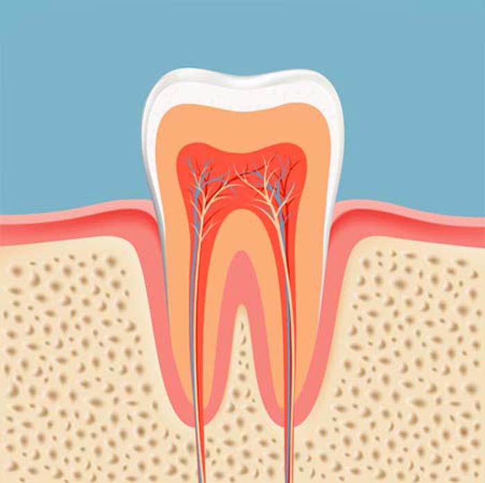 Root Canals in Lynwood, WA